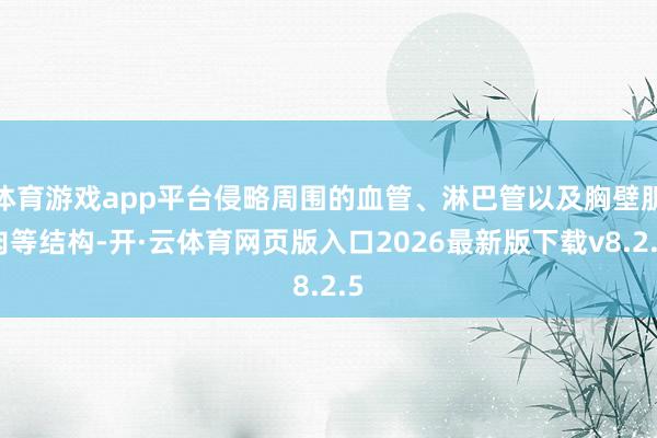 体育游戏app平台侵略周围的血管、淋巴管以及胸壁肌肉等结构-开·云体育网页版入口2026最新版下载v8.2.5